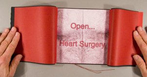 Open ... Heart Surgery by Michael Peven.